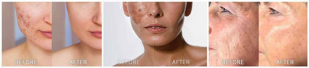 Kim's Skincare Protocol